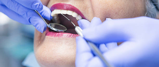 Best Emergency Treatment for Dental Infections or Abscesses in Upland, CA